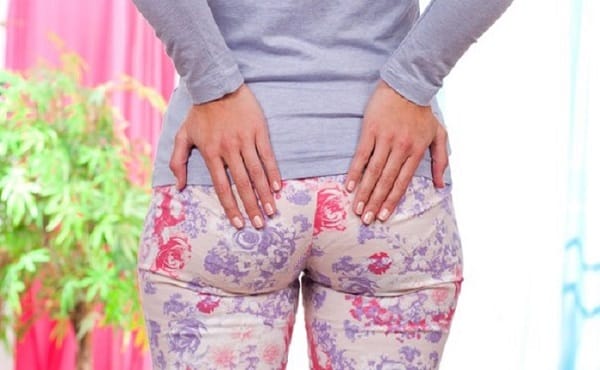 Мокнущий геморрой