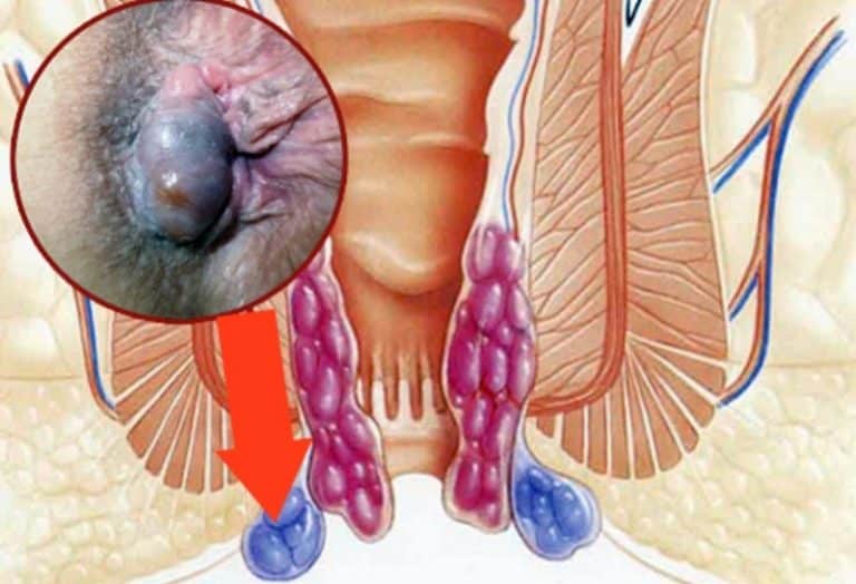 � ������ ������� � pic 11