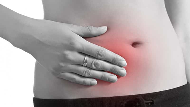 Что такое хронический аппендицит: признаки у мужчин и женщин