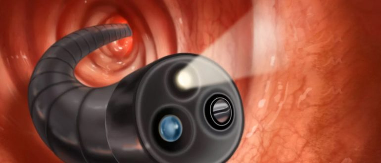 С какой стороны аппендицит: где находится у человека, в каком боку ...